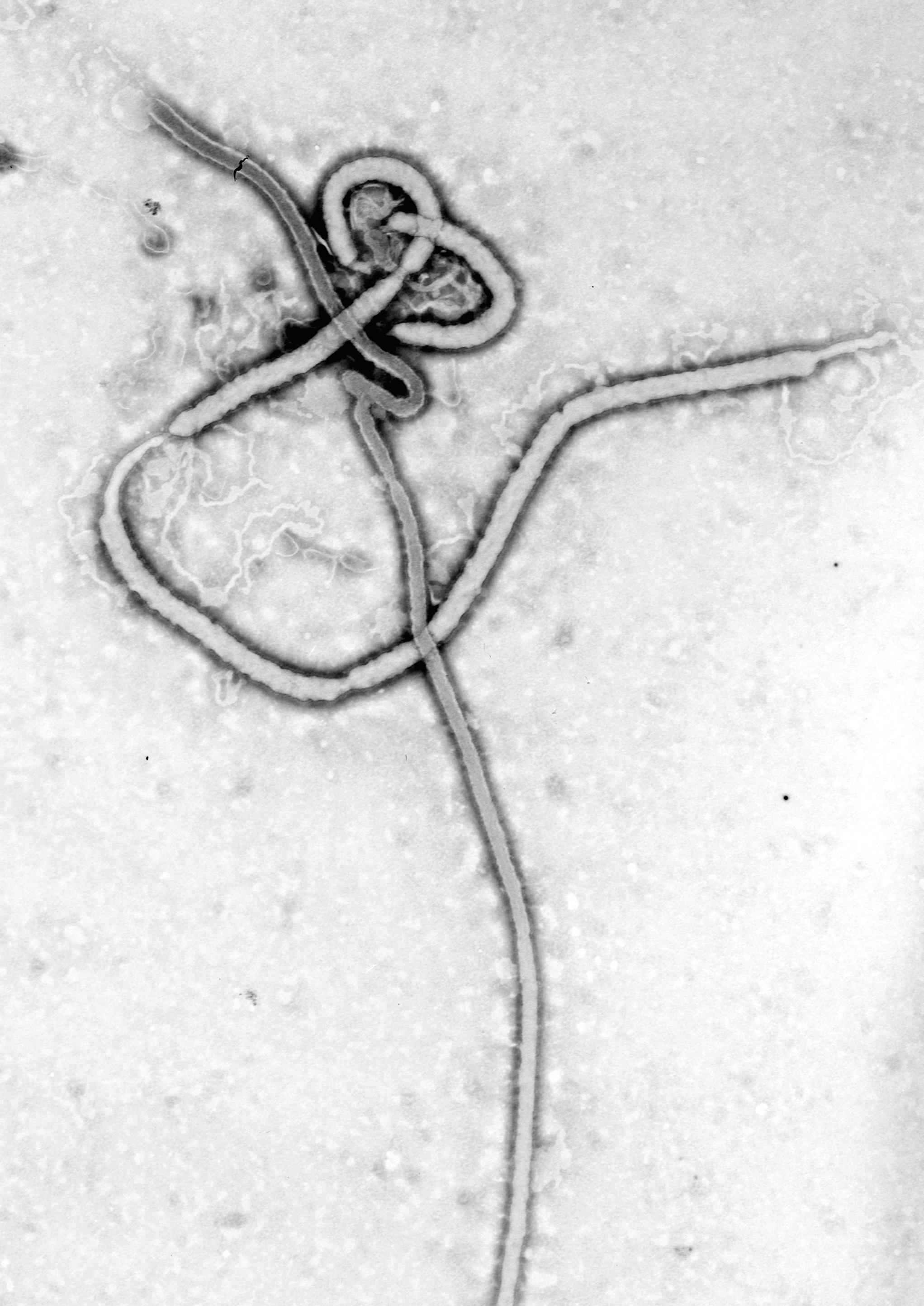 Electron microscope image of ebola virus