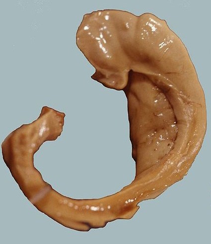 human hippocampus